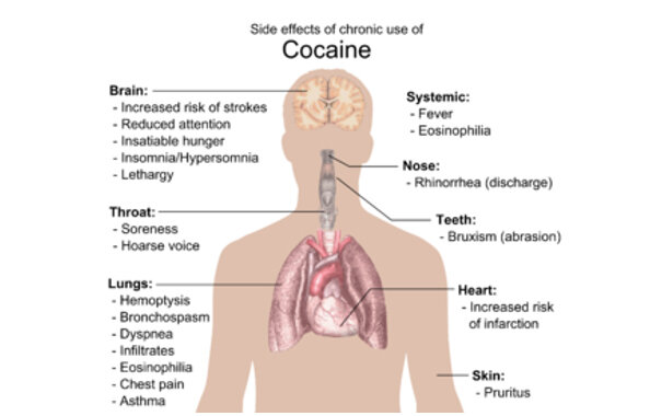 COCAINE What are the risks  toxicity.jpg
